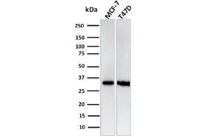 Western Blot Analysis of Human MCF-7, T47D cell lysates using RPA2 Recombinant Rabbit Monoclonal Antibody (RPA2/3140R). (Recombinant RPA2 抗体)