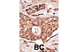 Formalin-fixed and paraffin-embedded human lymph with ICOS Antibody (C-term), which was peroxidase-conjugated to the secondary antibody, followed by DAB staining. (ICOS 抗体  (C-Term))