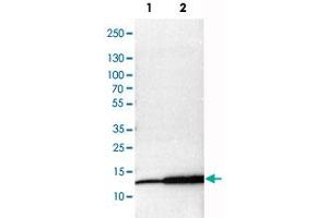 Western Blot analysis of Lane 1: NIH-3T3 cell lysate (mouse embryonic fibroblast cells), Lane 2: NBT-II cell lysate (Wistar rat bladder tumor cells) and Lane 3: PC12 cell lysate (pheochromocytoma of rat adrenal medulla) with MIF polyclonal antibody . (MIF 抗体)