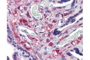 KIF20A antibody was used for immunohistochemistry at a concentration of 4-8 ug/ml. (KIF20A 抗体  (Middle Region))