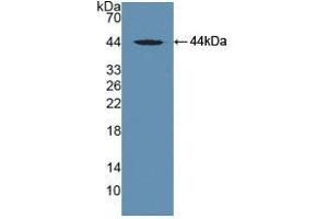 Detection of Recombinant DBP, Human using Polyclonal Antibody to Vitamin D Binding Protein (DBP) (Vitamin D-Binding Protein 抗体  (AA 395-474))