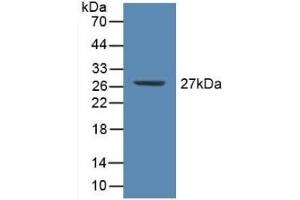 Detection of Recombinant CRP, Human using Polyclonal Antibody to C Reactive Protein (CRP) (CRP 抗体  (AA 17-224))