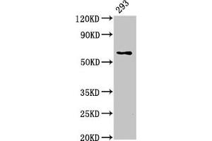 Western Blot Positive WB detected in: 293 whole cell lysate All lanes: LPCAT2 antibody at 5 μg/mL Secondary Goat polyclonal to rabbit IgG at 1/50000 dilution Predicted band size: 61, 31 kDa Observed band size: 61 kDa (LPCAT2 抗体  (AA 442-544))
