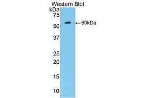 Western Blotting (WB) image for anti-Mannose-Binding Lectin (Protein C) 2, Soluble (MBL2) (AA 130-248) antibody (ABIN3206585) (MBL2 抗体  (AA 130-248))
