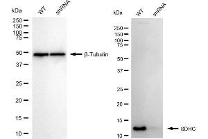 Western blotting analysis using SDHC antibody (ABIN7800455).