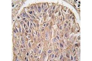 Immunohistochemistry (IHC) image for anti-Inhibitor of kappa Light Polypeptide Gene Enhancer in B-Cells, Kinase beta (IKBKB) antibody (ABIN3031320)