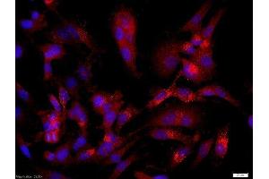 U251 cells (human glioma cells) were probed with Rabbit Anti-CASPR/Neurexin4 Polyclonal Antibody, Unconjugatedused at 1:200 dilution for 40 minutes at 37°C (CNTNAP1 抗体  (AA 151-250))