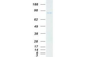 Western Blotting (WB) image for Tousled-Like Kinase 2 (TLK2) (Transcript Variant A) protein (Myc-DYKDDDDK Tag) (ABIN2712383)