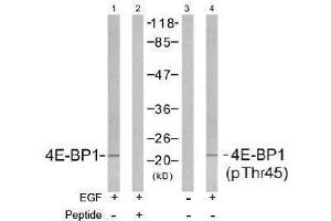 Image no. 2 for anti-Eukaryotic Translation Initiation Factor 4E Binding Protein 1 (EIF4EBP1) (pThr45) antibody (ABIN196966) (eIF4EBP1 抗体  (pThr45))