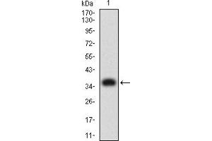 Western blot analysis using PLXNA1 mAb against human PLXNA1 (AA: 1100-1200) recombinant protein. (Plexin A1 抗体  (AA 1100-1200))
