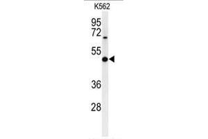 Western blot analysis of B3GAT1 Antibody (N-term) in K562 cell line lysates (35µg/lane).