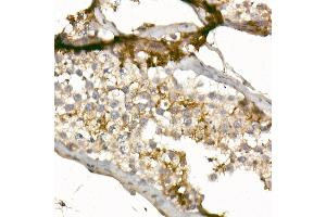 Immunohistochemistry (IHC) image for anti-CD99 (CD99) (AA 23-185) antibody (ABIN3022731)