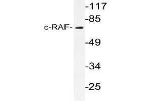 Western blot (WB) analyzes of c-RAF antibody in extracts from K562 cells. (RAF1 抗体)