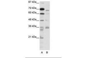 Image no. 1 for anti-Proprotein Convertase Subtilisin/kexin Type 6 (PCSK6) (AA 301-350) antibody (ABIN202833) (PCSK6 抗体  (AA 301-350))