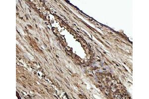 IHC analysis of YWHAE using anti-YWHAE antibody (ABIN7600163).