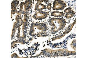 IHC analysis of DNAJA2 using anti-DNAJA2 antibody (ABIN7598991).