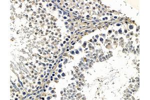 ABIN7096669 and ABIN7100734 at 1/100 staining rat testis tissue by IHC-P.