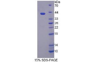 SDS-PAGE analysis of Mouse TSTA3 Protein. (TSTA3 蛋白)