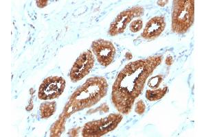 Immunohistochemistry (IHC) image for anti-V-Erb-A erythroblastic Leukemia Viral Oncogene Homolog 4 (Avian) (ERBB4) (AA 1116-1269) antibody (ABIN6939331)
