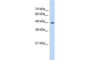 Western Blotting (WB) image for anti-Hydroxyacyl-CoA Dehydrogenase/3-Ketoacyl-CoA Thiolase/enoyl-CoA Hydratase (Trifunctional Protein), beta Subunit (HADHB) antibody (ABIN2463135) (HADHB 抗体)