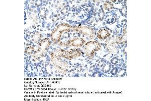 Rabbit Anti-PPP1R8 Antibody  Paraffin Embedded Tissue: Human Kidney Cellular Data: Epithelial cells of renal tubule Antibody Concentration: 4. (PPP1R8 抗体  (Middle Region))