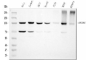Western blot analysis of MCM6 using anti-MCM6 antibody (ABIN7600038). (MCM6 抗体  (AA 14-821))