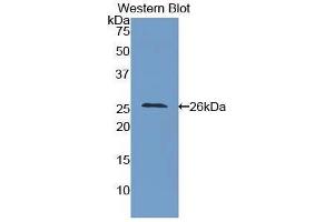 Western Blotting (WB) image for anti-Intercellular Adhesion Molecule 4 (ICAM4) (AA 32-226) antibody (ABIN1859244)