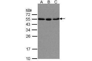 WB Image Sample(30 μg of whole cell lysate) A:HeLa S3, B:Hep G2, C:MOLT4, 10% SDS PAGE antibody diluted at 1:500 (KPNA2 抗体  (C-Term))