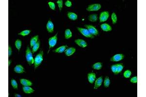 Immunofluorescent analysis of A549 cells using ABIN7157107 at dilution of 1:100 and Alexa Fluor 488-congugated AffiniPure Goat Anti-Rabbit IgG(H+L) (IDH3A 抗体  (AA 28-108))