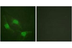 Immunofluorescence analysis of HeLa cells, using p53 (Ab-382) Antibody. (p53 抗体  (AA 344-393))