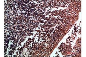 Immunohistochemical analysis of paraffin-embedded human-tonsil, antibody was diluted at 1:200 (Tenascin R 抗体  (AA 1270-1350))