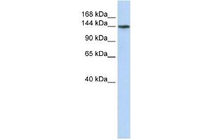 ATP11B antibody used at 1 ug/ml to detect target protein. (ATP11B 抗体  (N-Term))