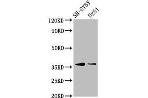 Western Blot Positive WB detected in: SH-SY5Y whole cell lysate, U251 whole cell lysate All lanes: BARHL1 antibody at 3. (BARHL1 抗体  (AA 38-176))