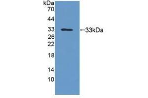 Detection of Recombinant UPb1, Human using Polyclonal Antibody to Beta-ureidopropionase (UPB1) (UPB1 抗体  (AA 121-384))