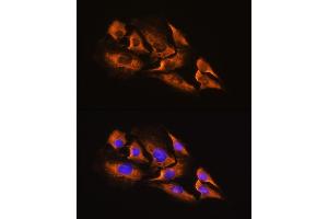 Immunofluorescence analysis of C6 cells using A Rabbit pAb (ABIN3016751, ABIN3016752, ABIN3016753 and ABIN6219833) at dilution of 1:100. (ADRA2A 抗体  (AA 240-380))