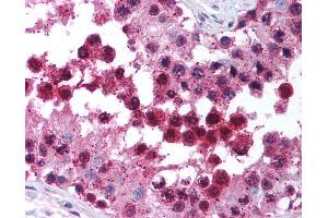 Anti-CUL9 / Cullin 9 antibody IHC of human testis. (CUL9 抗体  (C-Term))