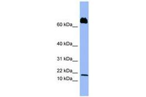 Image no. 1 for anti-Platelet Factor 4 Variant 1 (PF4V1) (C-Term) antibody (ABIN6741683) (PF4V1 抗体  (C-Term))