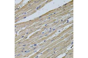 Immunohistochemistry of paraffin-embedded rat heart using EIF4A2 antibody.