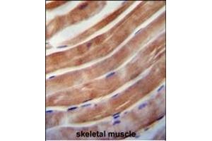 KE antibody (C-term) 0092b immunohistochemistry analysis in formalin fixed and paraffin embedded human skeletal muscle followed by peroxidase conjugation of the secondary antibody and DAB staining. (KEAP1 抗体  (C-Term))