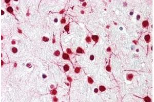 Human Brain, Cortex: Formalin-Fixed, Paraffin-Embedded (FFPE) (DELE1/KIAA0141 抗体  (N-Term))