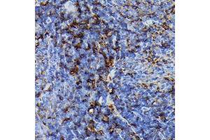 Immunohistochemistry of paraffin-embedded rat spleen using FADD Rabbit mAb (ABIN7267135) at dilution of 1:100 (40x lens). (FADD 抗体)
