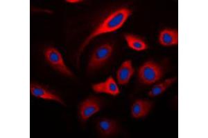 Immunofluorescent analysis of HADH2 staining in SKNSH cells. (HSD17B10 抗体  (Center))