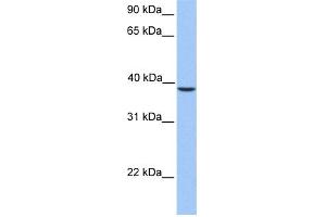 WB Suggested Anti-SUNC1 Antibody Titration: 0. (SUN3 抗体  (C-Term))