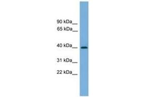 Image no. 1 for anti-serpin Peptidase Inhibitor, Clade B (Ovalbumin), Member 8 (SERPINB8) (AA 251-300) antibody (ABIN6745215) (SERPINB8 抗体  (AA 251-300))