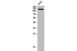 Western Blotting (WB) image for anti-Collagen, Type II, alpha 1 (COL2A1) (N-Term) antibody (ABIN7188642)