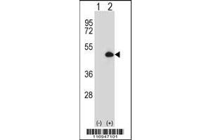 Western blot analysis of CYP20A1 using rabbit polyclonal CYP20A1 Antibody using 293 cell lysates (2 ug/lane) either nontransfected (Lane 1) or transiently transfected (Lane 2) with the CYP20A1 gene.