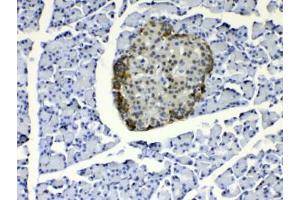 IHC testing of FFPE rat pancreas tissue with COPE antibody at 1ug/ml. (COPE 抗体)