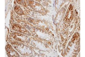IHC-P Image Immunohistochemical analysis of paraffin-embedded human colon, using PD-L1, antibody at 1:100 dilution. (PD-L1 抗体  (C-Term))