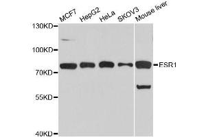 Western blot analysis of extracts of various cell lines, using ESR1 antibody. (Estrogen Receptor alpha 抗体  (AA 1-190))