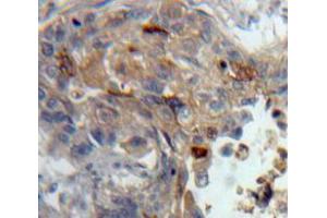 Used in DAB staining on fromalin fixed paraffin-embedded Lung tissue (PKC theta 抗体  (AA 380-634))